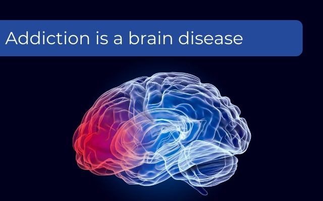 Addiction is a brain disease explained